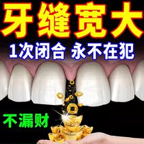 Metallurgical Periodontitis Tooth Loose Gingival Swelling Pain Bleeding Atrophy Repair God Instrumental Tooth Slit Leniency of Medicated Toothpaste