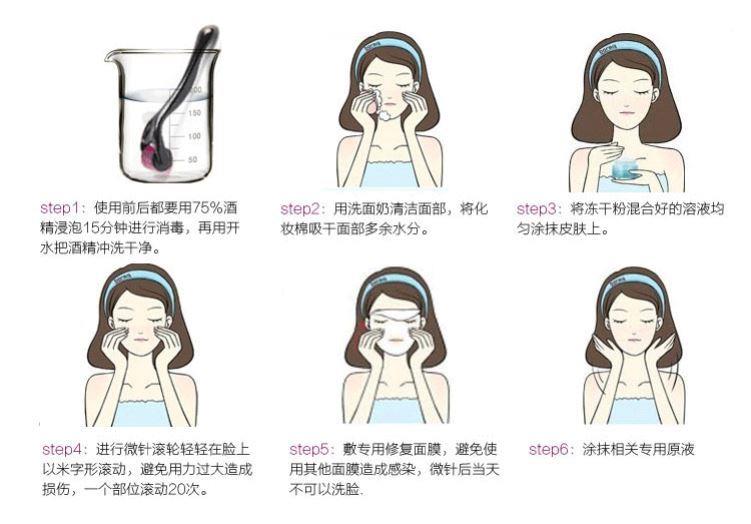 Micro-needle roller roller OUI needle hair facial beauty salon Cosmetic Surgery GOLD MOVEMENT NANO INSTRUMENT SPECIAL FACE DEPARTMENT