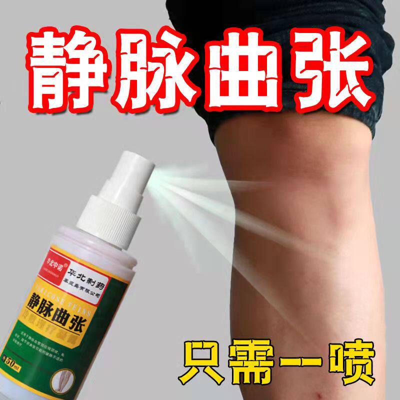 Vein varicose spray agent earthworm leg red blood filament, swelling and puffy old leg YY