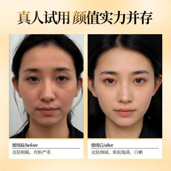 Tilylo American Imported Collagen Tablets for Oral Use, Anti-Glycation and Anti-Oxidation Beauty Pills for Whole-Body Whitening Olw