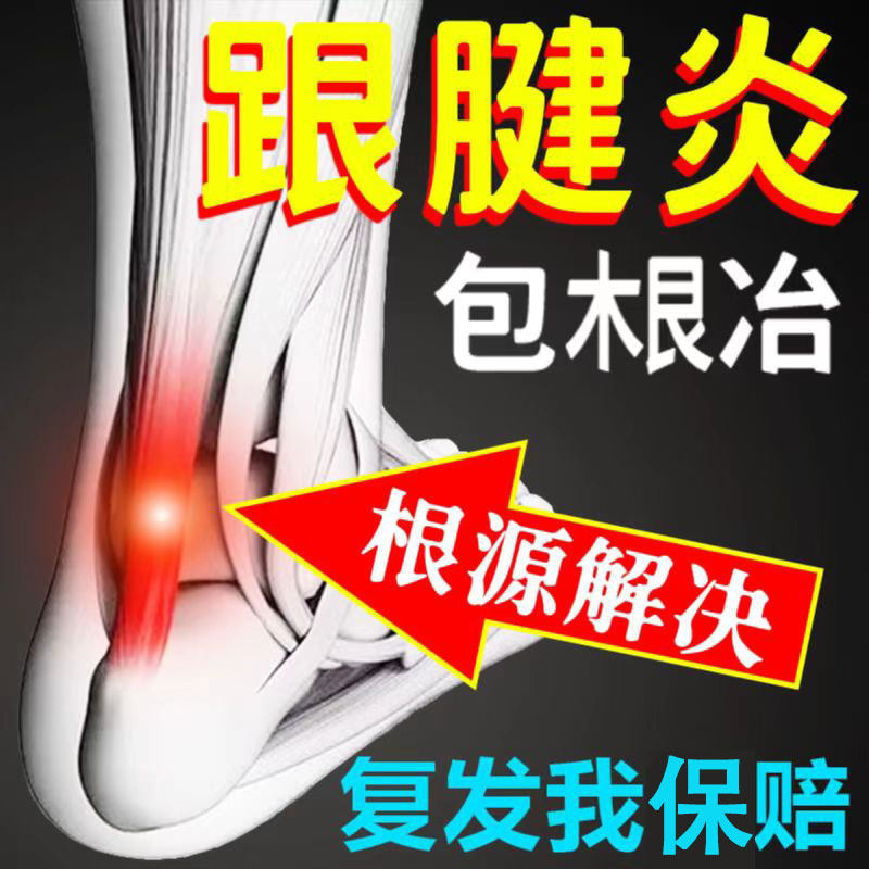Achilles tendon inflammation special ointment paste heel pain special paste heel pain fascia Yan artifact cold compress gel