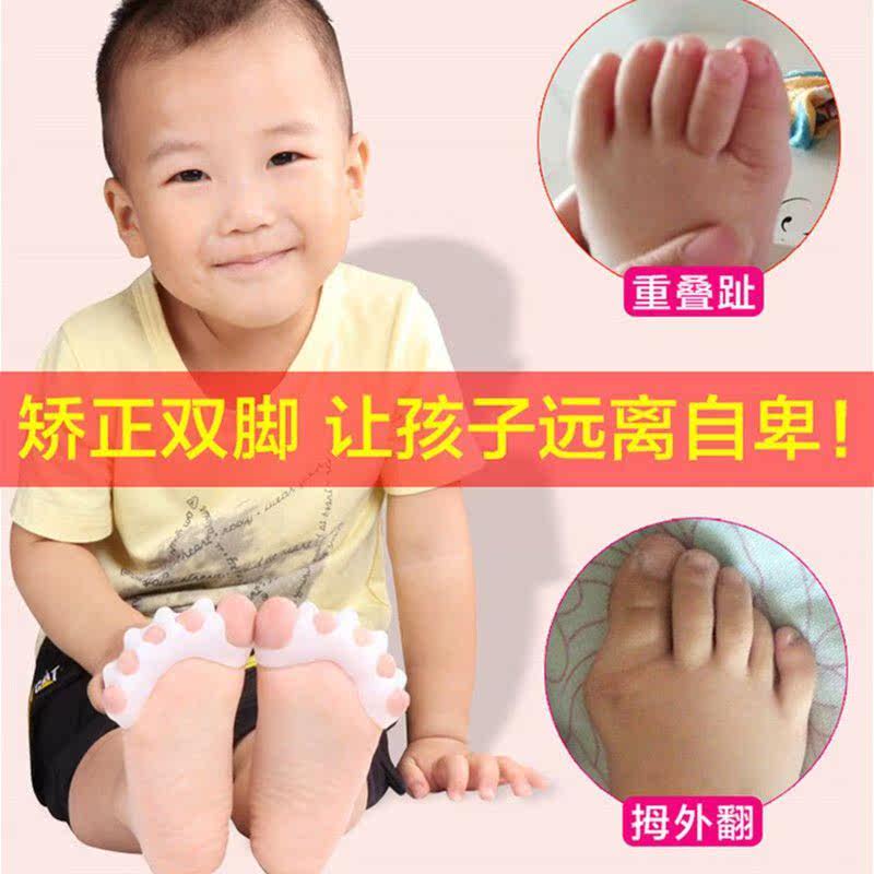 Baby's big foot bone thumb valgus correction device for baby's toddler's toe overlap toe splitting device for day and night use