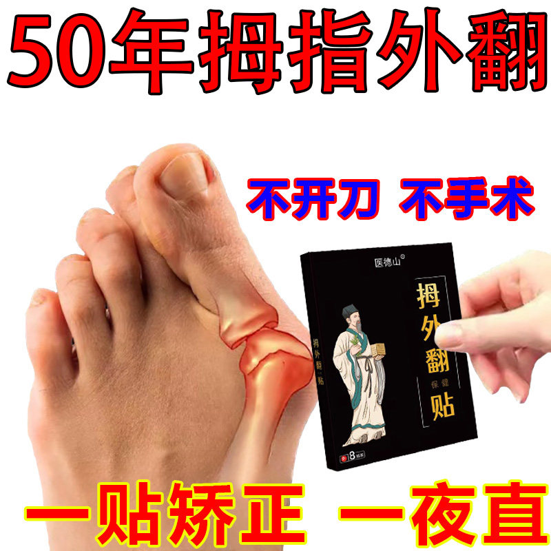 (200% can be cured) hallux valgus corrector artifact lady thumb big toe overlapping hallux valgus plaster