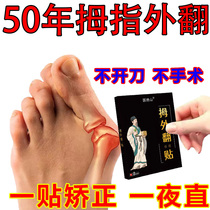 (200% Can Be Cured) Hallux Valgus Straightener Lady Thumb Large Toe Overlap Thumb Valgus Patch Paste