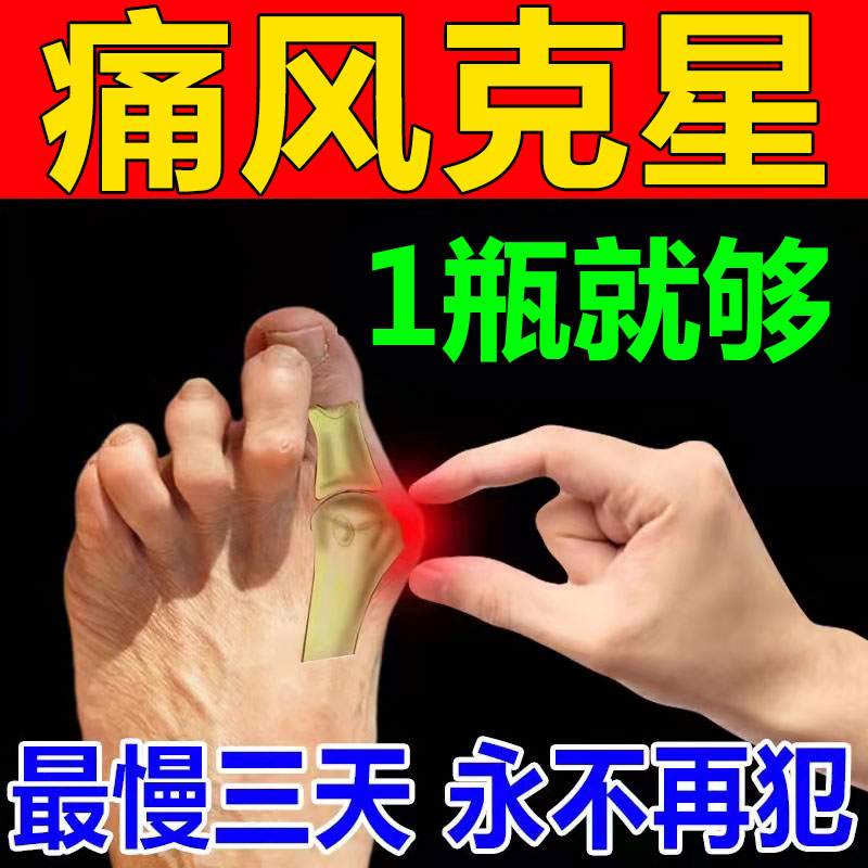(Pain relief that night) New version of gout special medicine for reducing uric acid and crystallizing toe and finger swelling and pain gout cream XW