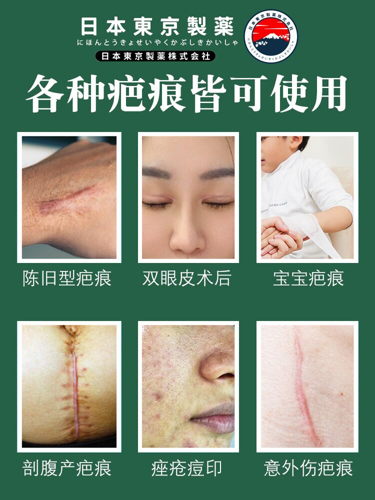 Убрать растяжки массажер 【日本爆款热卖】日系疤痕滚珠修复剖腹产增生凹凸疤痕全身 OTHER