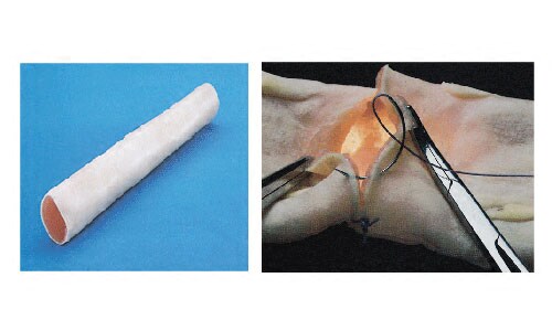 医学用肠管吻合模型(30mm直径20)肠吻合技术技巧训练模具教学练习