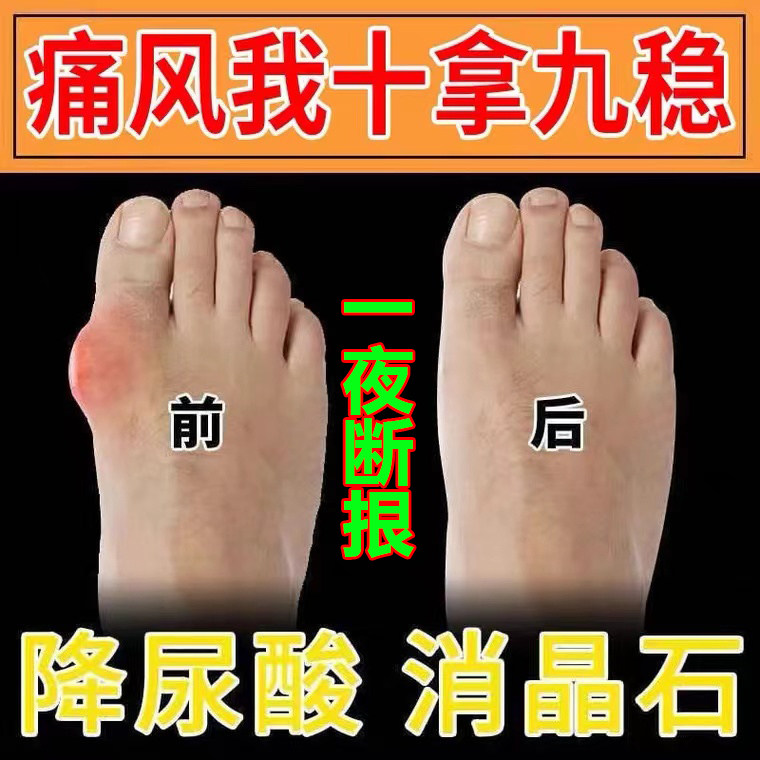 Special effect medicine for gout, new version of uric acid-lowering medicine
