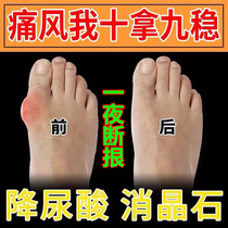 Gout special medicine downpour uric acid new cold compress special traditional Chinese medicine post traditional Chinese medicine paste Crystalline Gram ointment soluble stone special medicine