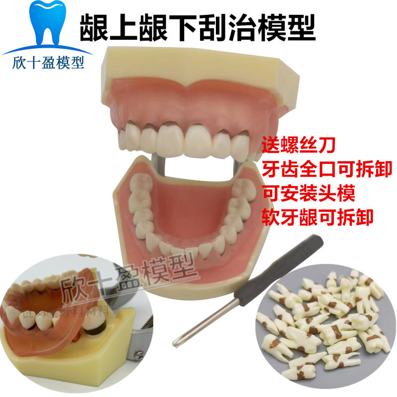 牙科教学模型 牙周病理模型 练习刮治结石 牙周教学医患沟通4023