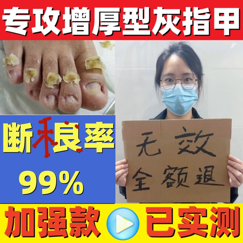 Nail Bed Repair Growth Solution Is a Specialized Treatment for Damaged Nails, Designed to Regenerate and Nourish the Nail Bed, Address Separation of Nails, and Promote the Growth of Free Nails Nail Bed Repair Growth Solution Is a Specialized Treatment for Damaged Nails, Designed to Regenerate and Nourish the Nail Bed, Address Separation of Nails, and Promote the Growth of Free Nails