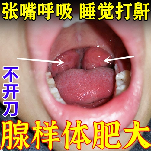 Детские дыхательные освежающие ортезы для сна от заложенности носа