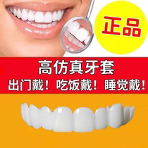 National Xingdentaire Braces For Dinner Theorist elderly men and women Whitening Sedenture Tooth Deficiency Dental Braces for Tooth Patches of Tooth Patches