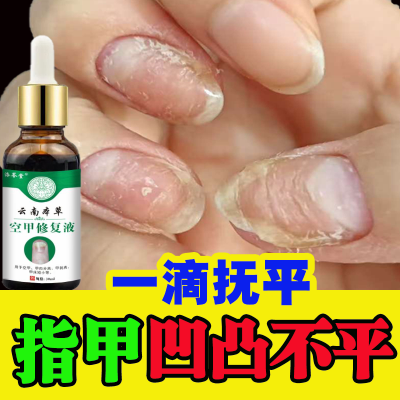 Nail Polish for Uneven Nail Surface Repair, Nail Indentations, Peeling, Unevenness, Hollow Nails, Pitted Nails, Nail Nutrition Oil