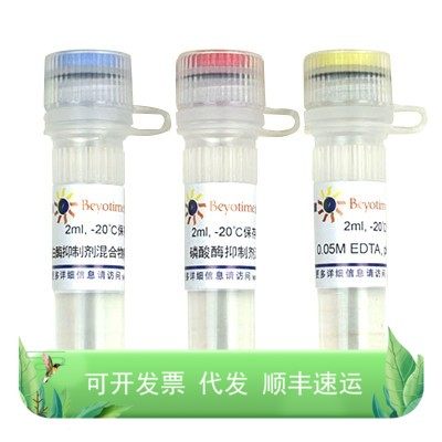 P1045 蛋白酶磷酸酶抑制剂混合物(通用型 , 50X) 各2ml