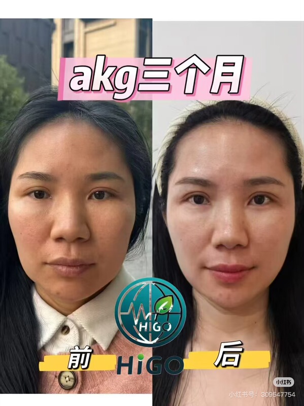 【Akg New Product Launch】Always 18-Year-Old, Flower-Like Woman, 7-8 Years Old