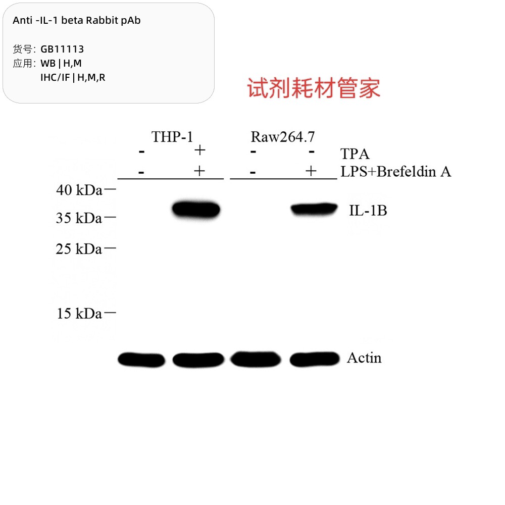 Anti-IL-1 beta Rabbit pAb,抗IL-1beta兔pAb,GB11113-100,100&mu;L