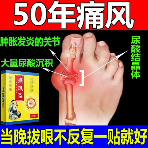 [Импортировано в Японии] подагра Специальные эффекты Медицина Артроцитарная Снижение боли Специальные эффекты Медицина лечение подагра сжатие новая версия.