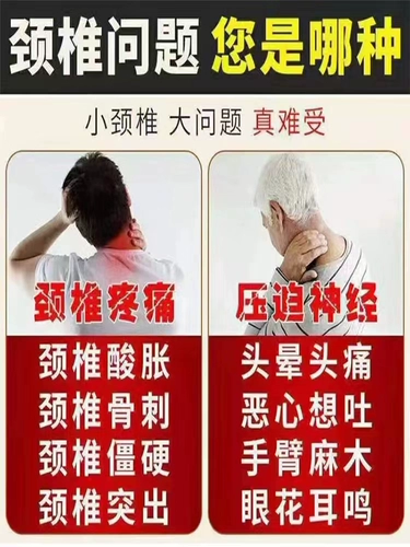 Специальное лекарство от шейного спондилоза [сломанная пятка] боль шейки матки, головокружение, головокружение, шея, жесткость, болезненная рука, рука, рука,
