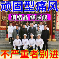 (Gout even night away) Special effects gout cream Uric Acid Soluble Crystallization Toe Joint Redness Drum Bag Deformation Special