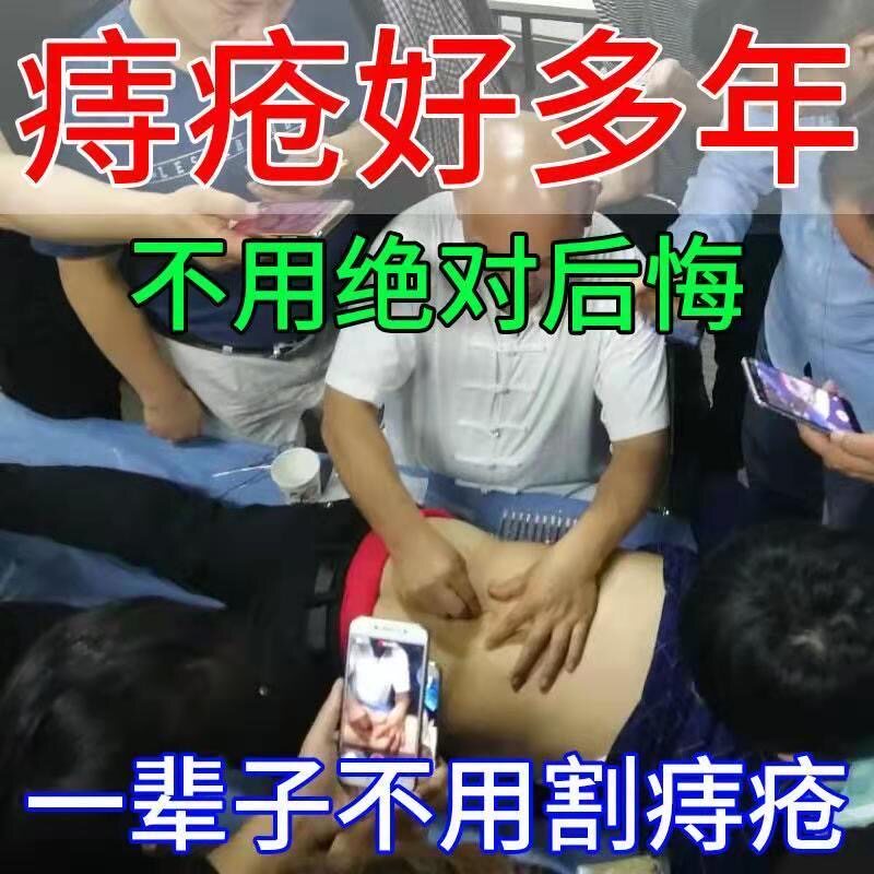 Hemorrhoids paste spherical spherical anal pain and hemorrhoids mixed hemorrhoids with anal and surrogate hemorrhoids