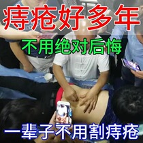 Haemorrhoids Cream Meatball Swollen Large Anal Pain Stool Bleeding Internal Haemorrhoids Mixed Haemorrhoids Anal Cracking Constipation Postpartum Haemorrhoids