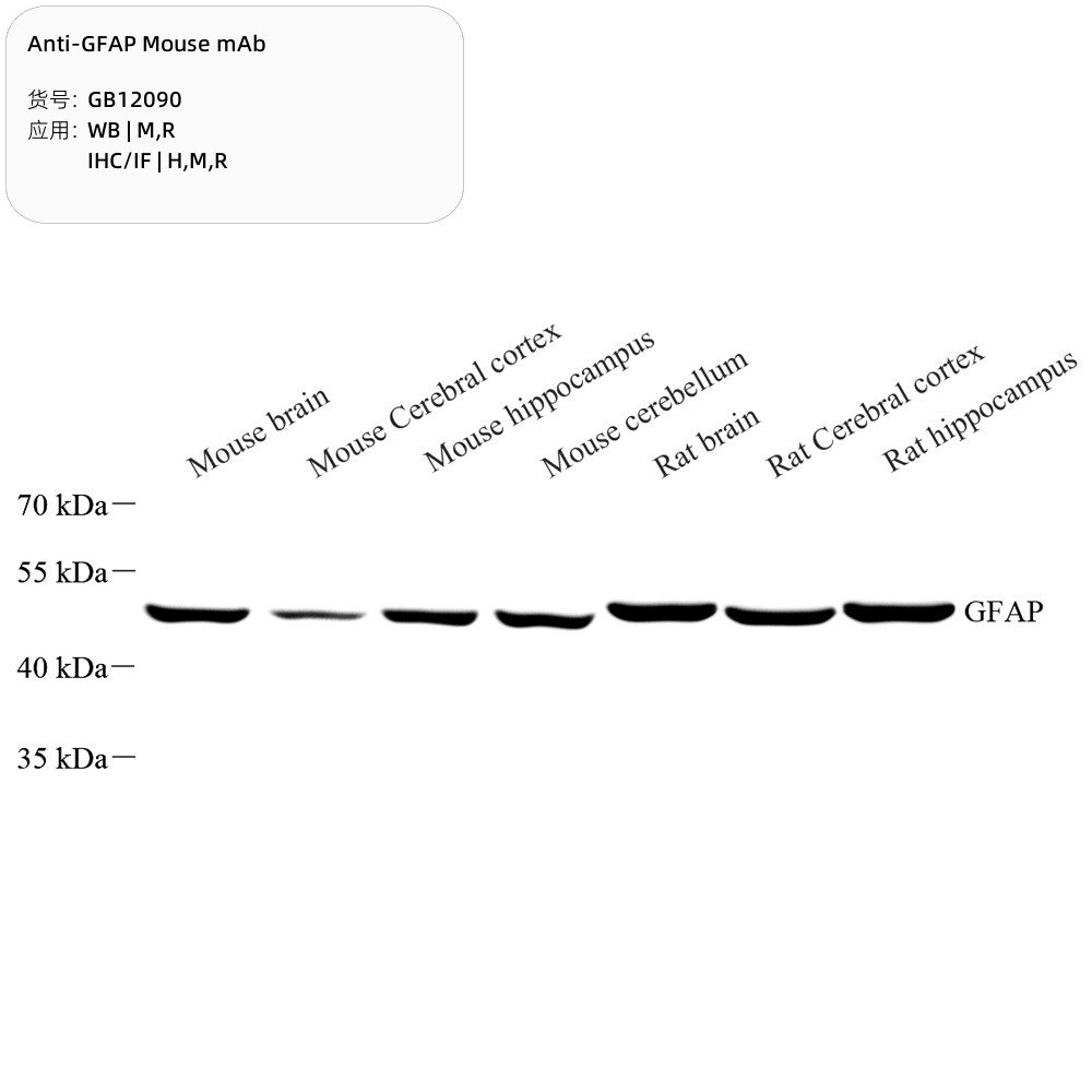 Servicebio 抗GFAP小鼠单克隆抗体,适用WB/IHC/IF,应用种属H/M/R