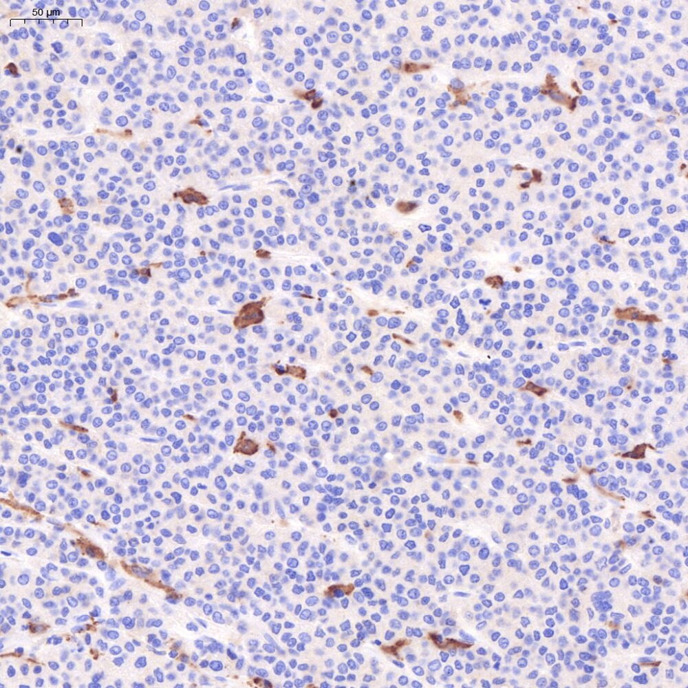 Servicebio抗CD163兔pAb抗体,Anti-CD163 Rabbit pAb,适用IHC/IF