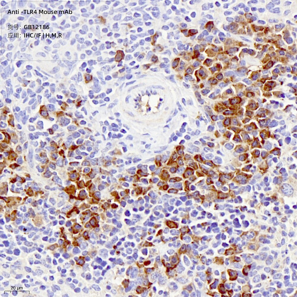 Servicebio抗-TLR4小鼠单克隆抗体,适用IHC/IF,应用种属H/M/R