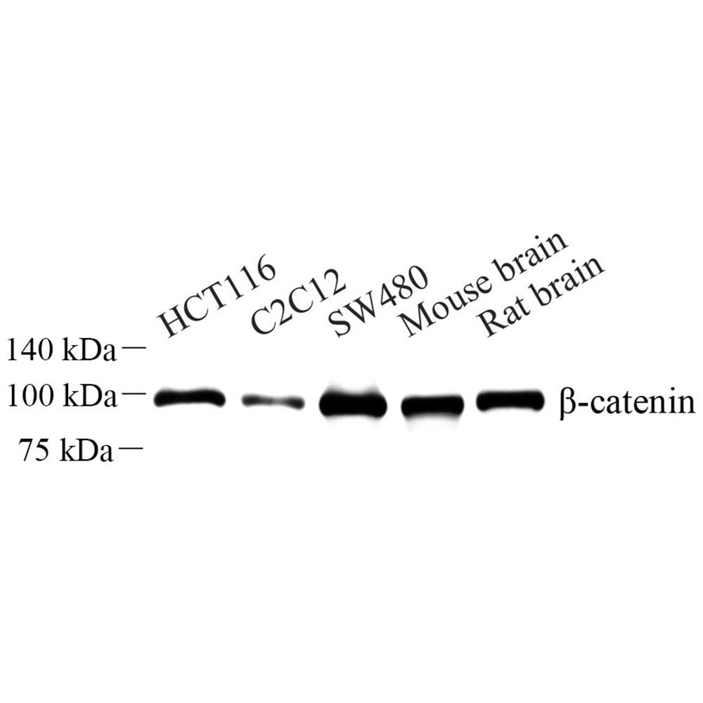 抗&beta;连环蛋白兔pAb抗体,Anti-beta Catenin Rabbit pAb,WB/IHC/IF