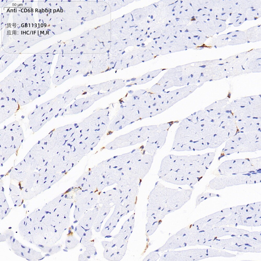 Servicebio 抗-CD68兔pAb抗体,Anti-CD68 Rabbit pAb,适用IHC/IF