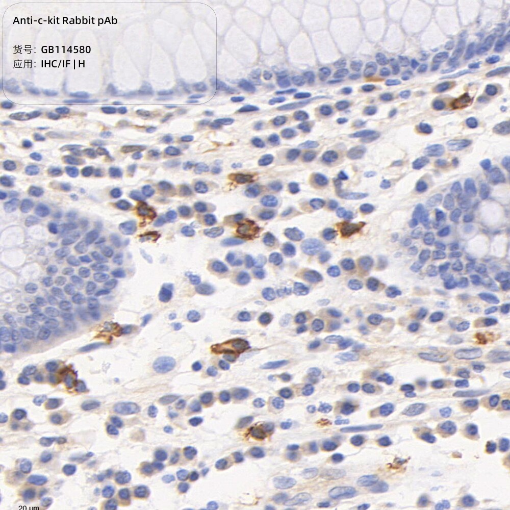 Servicebio抗c试剂兔pAb抗体,Anti-c-kit Rabbit pAb,适用IHC/IF