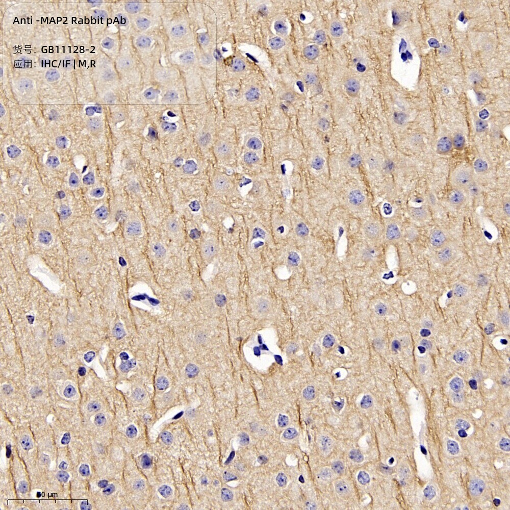 Servicebio抗-MAP2兔pAb抗体适用IHC/IF种属M/R,神经纤维推荐抗体