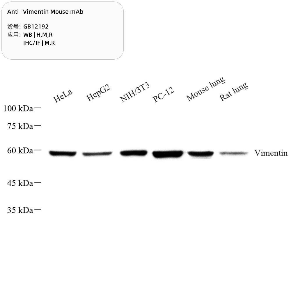 Servicebio抗维门汀小鼠单克隆抗体,适用WB/IHC/IF,应用种属H/M/R