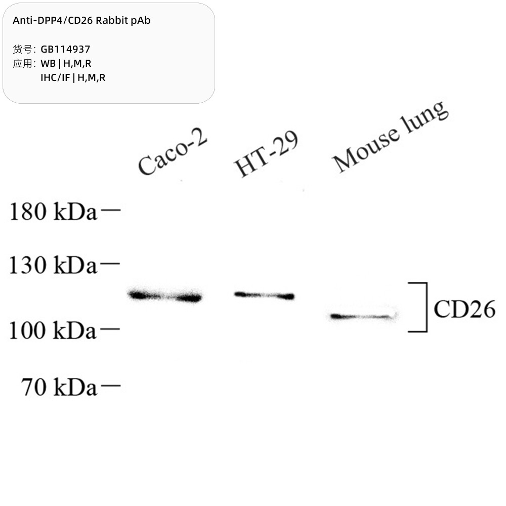 抗DPP4/CD26兔pAb抗体,Anti-DPP4/CD26 Rabbit pAb,适用WB/IHC/IF