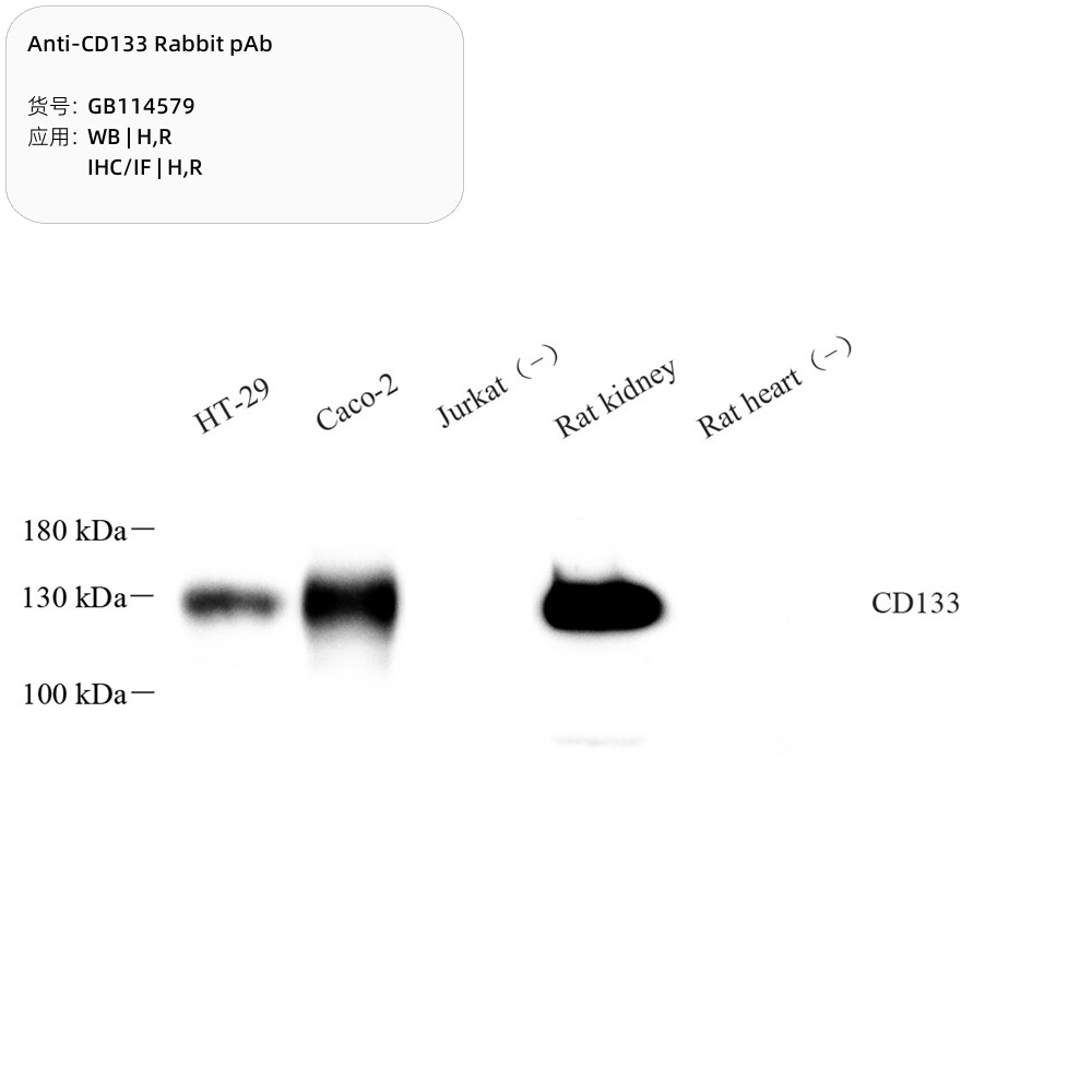 Servicebio抗CD133兔pAb抗体Anti-CD133 Rabbit pAb适用WB/IHC/IF