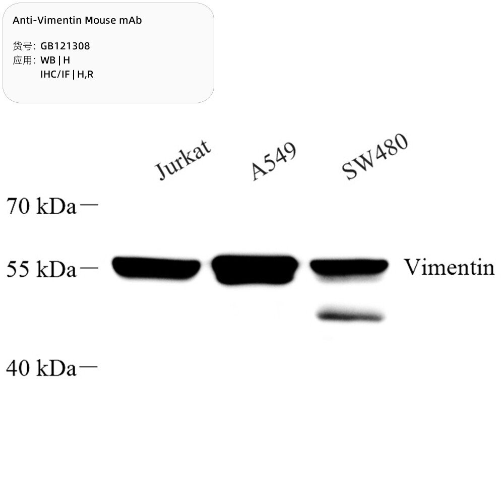 Servicebio抗病毒素小鼠单克隆抗体 Anti-Vimentin 适用WB/IHC/IF