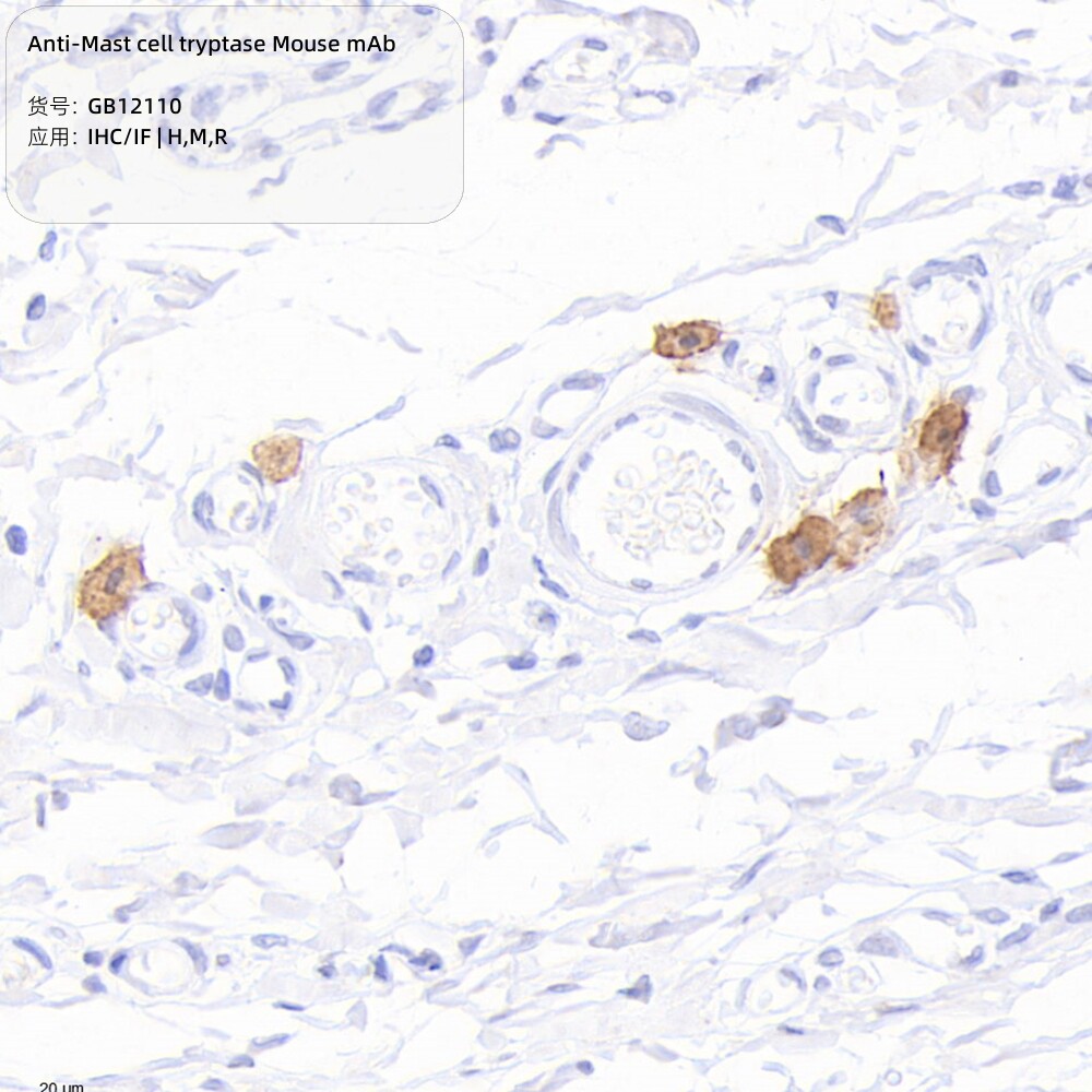 Servicebio抗肥大细胞类胰蛋白酶小鼠单克隆抗体100&mu;L适用IHC/IF
