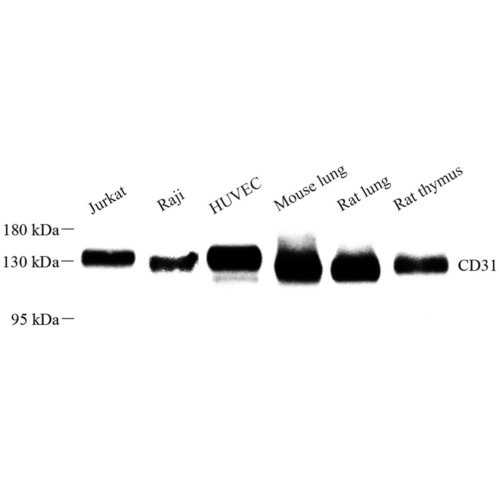 抗-CD31兔pAb抗体,Anti-CD31 Rabbit pAb,适用WB/IHC/IF,推荐抗体