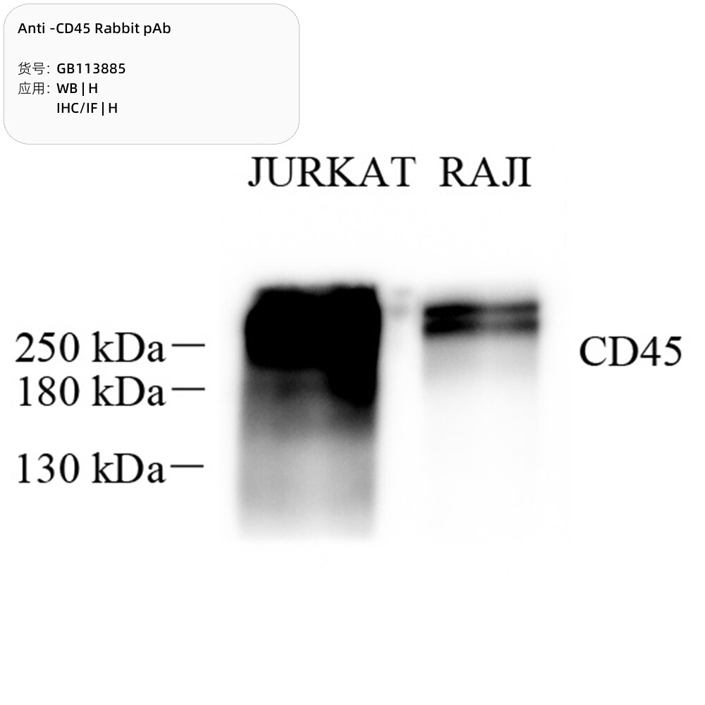 Servicebio抗-CD45兔pAb抗体Anti-CD45 Rabbit pAb,适用WB/IHC/IF