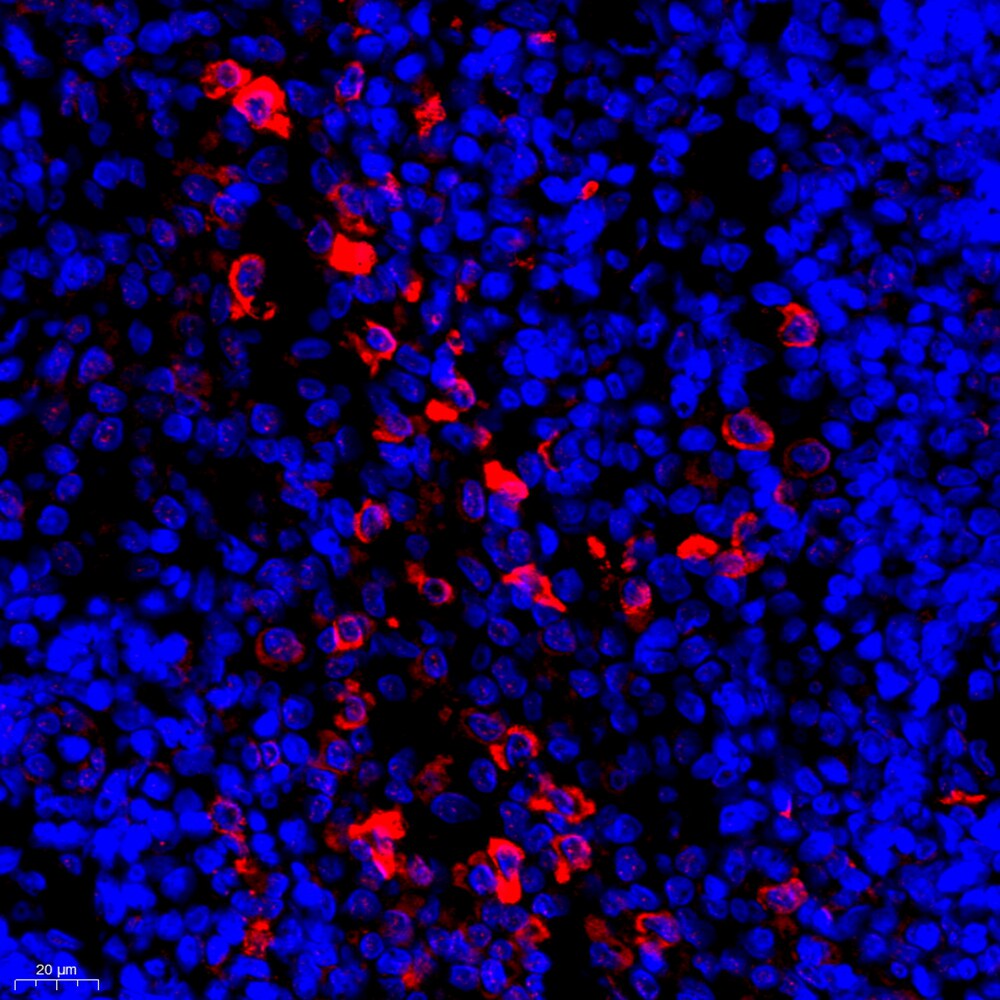 Servicebio抗CD163兔pAb抗体Anti-CD163Rabbit pAb适用IHC/IF推荐