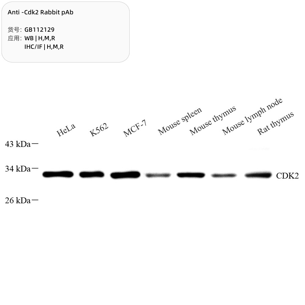 抗-CDK2兔pAb抗体,适用WB/IHC/IF,种属H/M/R细胞周期推荐抗体热卖
