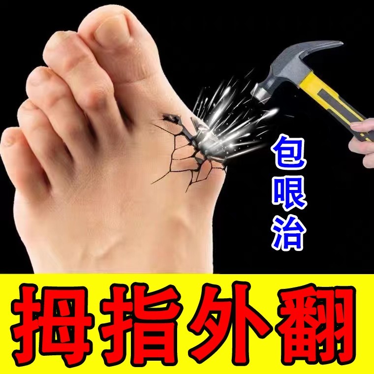(fastest three days) Thumb Valgus correction Divine Instrumental Female Large Footed Bone Deformation Toe Joint Pain Special Sticker-Taobao