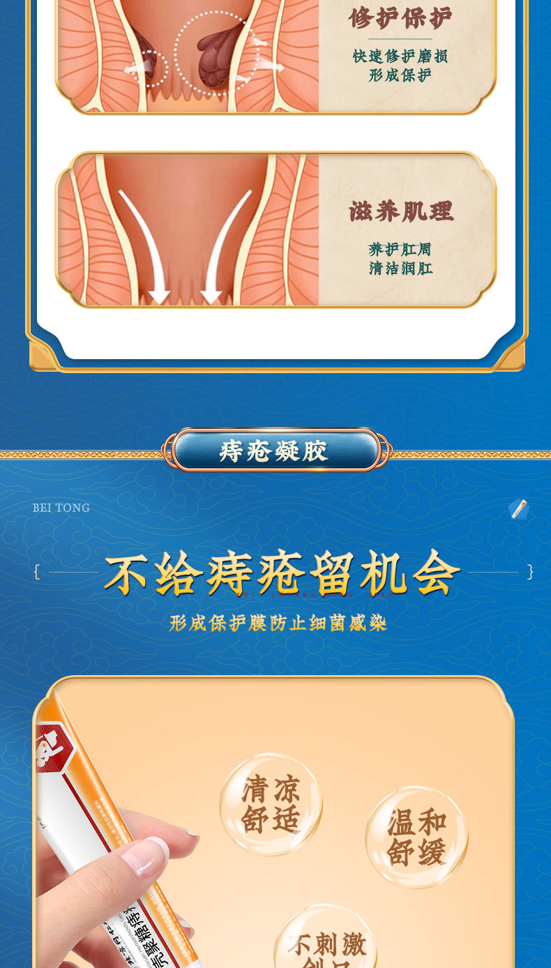 【中國直郵】北京同仁堂殼聚醣痔瘡凝膠痔瘡膏消肉球凝膠內外痔肛門搔癢肛裂癒合藥膏20g/支