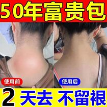 Wealth package eliminates the sticker as long as rich do not pack repair neck large vertebral drum pack correction massage loop