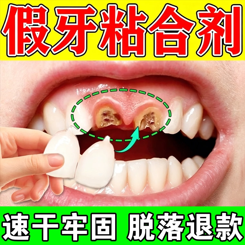 Denture Adhesive, Tooth Loosening Fixation Glue, Porcelain Tooth Bonding Agent, Self-Adhesive Porcelain Tooth Medical Glue, Special Glue