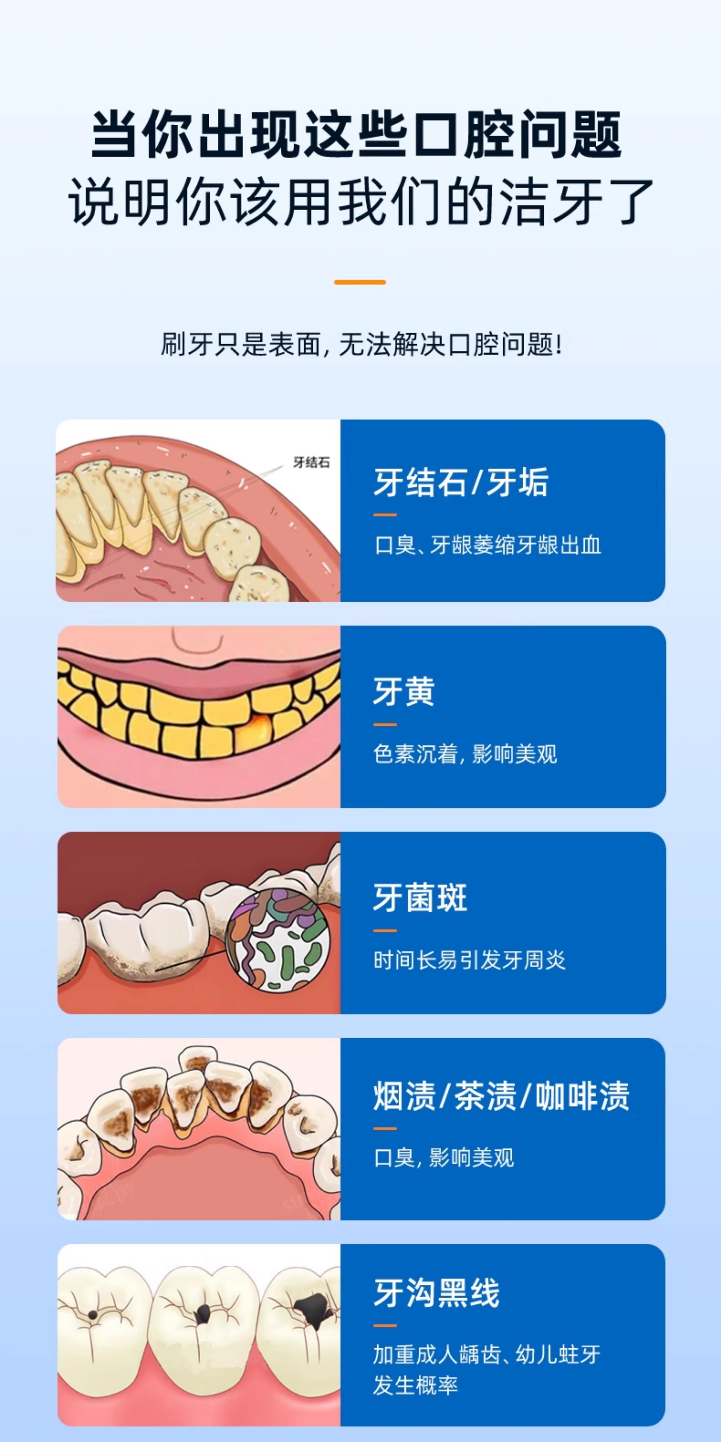 【中国直邮】 康佳 超声波洗牙器 冲牙洁牙去除除牙石结石神器清洁牙齿污垢牙石仪 闪耀白 充电款 1个装