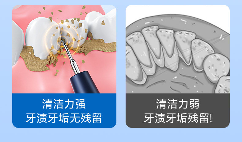 【中国直邮】 康佳 超声波洗牙器 冲牙洁牙去除除牙石结石神器清洁牙齿污垢牙石仪 闪耀白 充电款 1个装