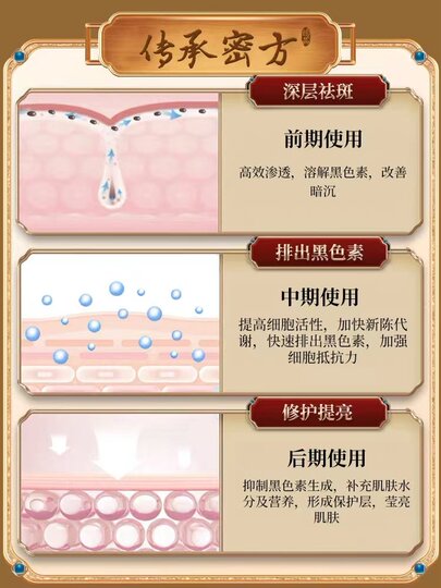 Powerful Removal of Age Spots, Special Cream for Hands and Face to Remove Melanin, Genuine Ointment for Removing Chloasma for the Elderly