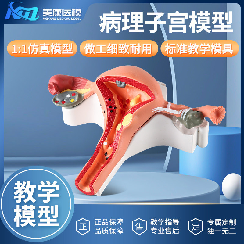 人体女性生殖子宫解剖病理模型阴道卵巢教学模型妇科生殖科教具